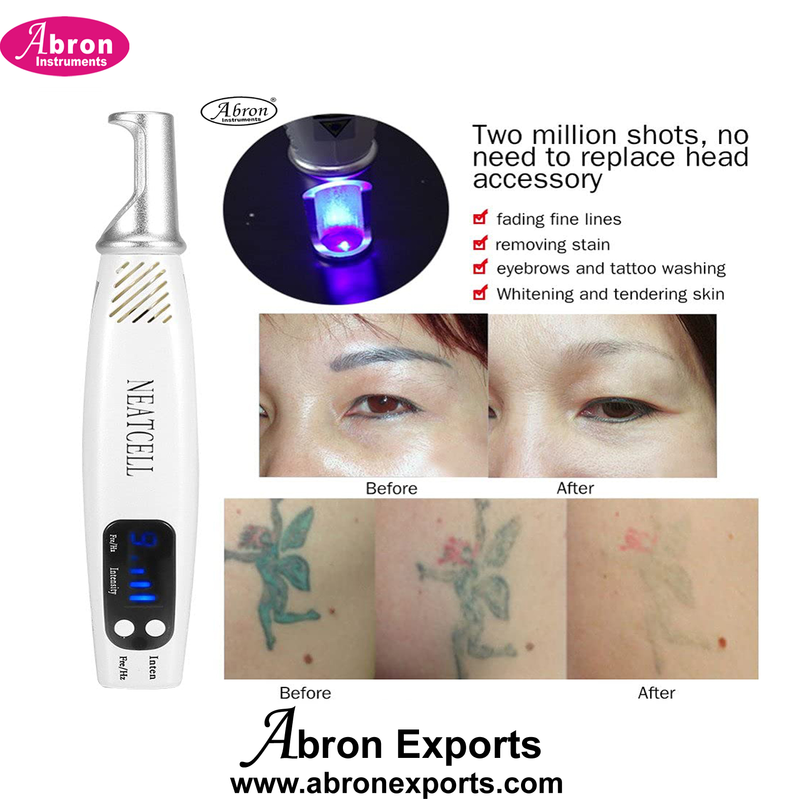 Laser Machine Pen Tattoo Remover Mole Freckle Spot Removel Machine Abron ABM-2678P 